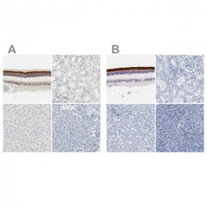 Anti-IMPG2 antibody produced in rabbit 