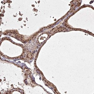 Anti-ING5 antibody produced in rabbit 