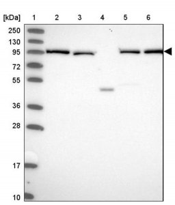 Anti-INO80D antibody produced in rabbit HPA043976-100UL