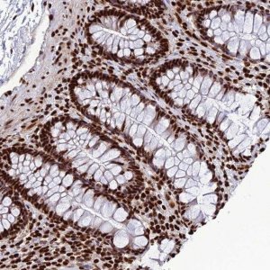 Anti-INO80E antibody produced in rabbit 