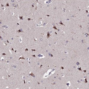 Anti-INPP4A antibody produced in rabbit 
