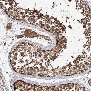 Anti-INPP4B antibody produced in rabbit 