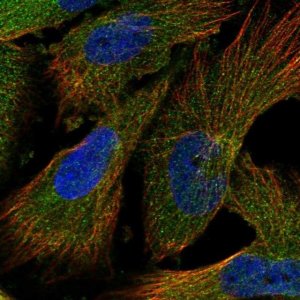 Anti-INPP5B antibody produced in rabbit 
