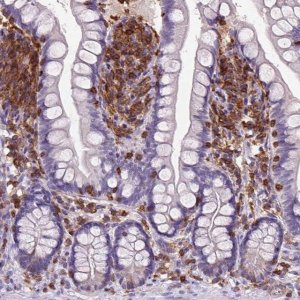Anti-INPP5D antibody produced in rabbit 