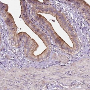 Anti-INPP5E antibody produced in rabbit 