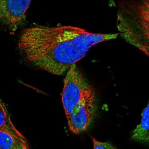 Anti-INPPL1 antibody produced in rabbit 