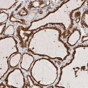Anti-INTS1 antibody produced in rabbit HPA021658-100UL