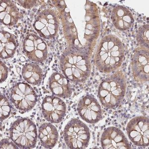 Anti-INTS4 antibody produced in rabbit 