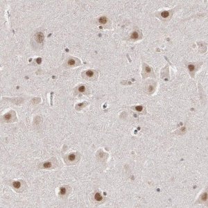 Anti-INTS6 antibody produced in rabbit 