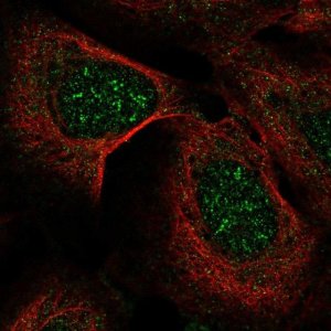 Anti-IP6K2 antibody produced in rabbit 
