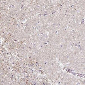 Anti-IP6K3 antibody produced in rabbit 