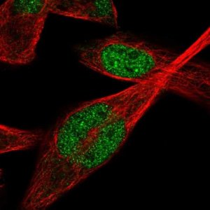 Anti-IPMK antibody produced in rabbit 
