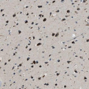 Anti-IPO7 antibody produced in rabbit 