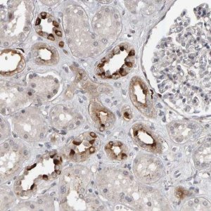 Anti-IPO8 antibody produced in rabbit 