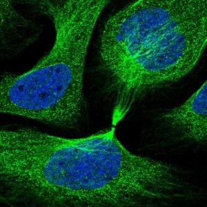 Anti-IQCB1 antibody produced in rabbit 
