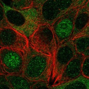 Anti-IRAK1 antibody produced in rabbit 
