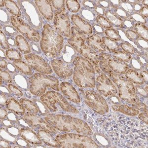 Anti-IRAK2 antibody produced in rabbit 