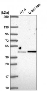 Anti-IRF2 antibody produced in rabbit 