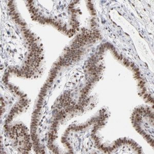 ANTI-IRF9 antibody produced in rabbit 