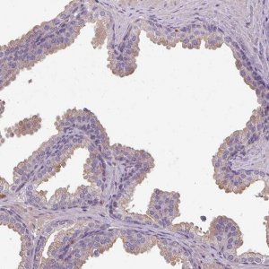 Anti-ISLR antibody produced in rabbit 