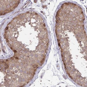 Anti-IST1 antibody produced in rabbit 