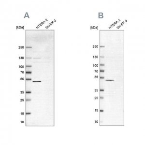 Anti-IST1 antibody produced in rabbit HPA041802-100UL