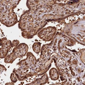 Anti-IST1 antibody produced in rabbit HPA041802-100UL
