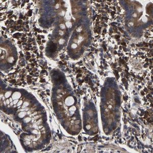 Anti-ITCH antibody produced in rabbit 