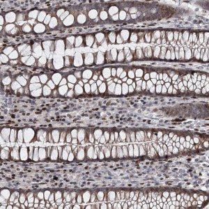 Anti-ITFG2 antibody produced in rabbit 