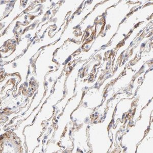 Anti-ITGA8 antibody produced in rabbit 