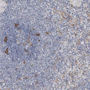 Anti-ITGAD antibody produced in rabbit 