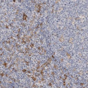 Anti-ITGAD antibody produced in rabbit 