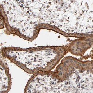 Anti-ITGAV antibody produced in rabbit 