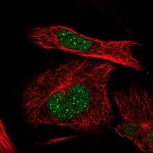 Anti-ITGB1BP1 antibody produced in rabbit 