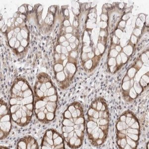 Anti-ITGB3BP antibody produced in rabbit 