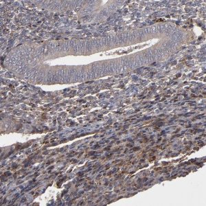 Anti-ITGB5 antibody produced in rabbit 