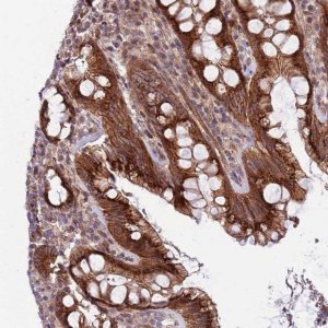 Anti-ITGB6 antibody produced in rabbit 
