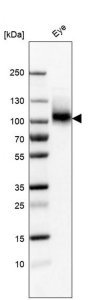 Anti-ITGB8 antibody produced in rabbit 