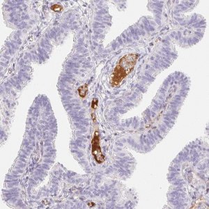 Anti-ITIH2 antibody produced in rabbit 