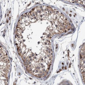 Anti-ITIH3 antibody produced in rabbit 