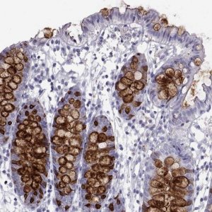 Anti-ITLN1 antibody produced in rabbit 