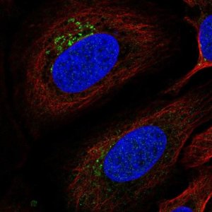 Anti-ITM2B antibody produced in rabbit 