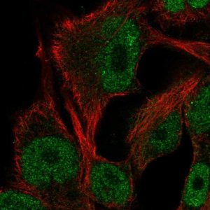 Anti-ITPKB antibody produced in rabbit 