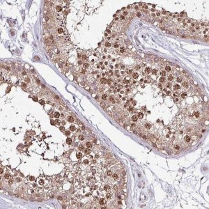Anti-ITPKC antibody produced in rabbit 