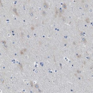 Anti-ITPR1 antibody produced in rabbit 