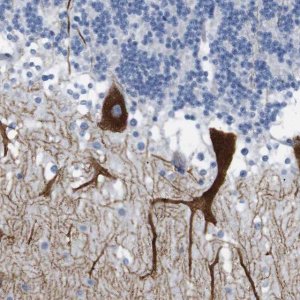 Anti-ITPR1 antibody produced in rabbit HPA014765-100UL