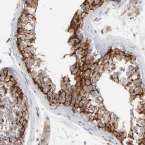 Anti-ITPR3 antibody produced in rabbit 