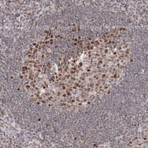 Anti-IWS1 antibody produced in rabbit 
