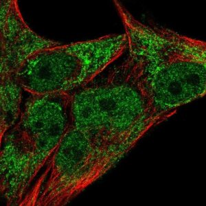 Anti-JARID2 antibody produced in rabbit 