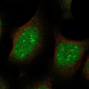 Anti-JAZF1 antibody produced in rabbit 